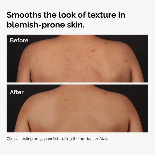 Product Salicylic Acid 0.5% Body Serum 240ml base image