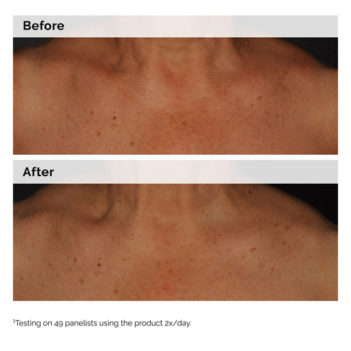 Product Niacinamide 5% Face & Body Emulsion 100ml base image