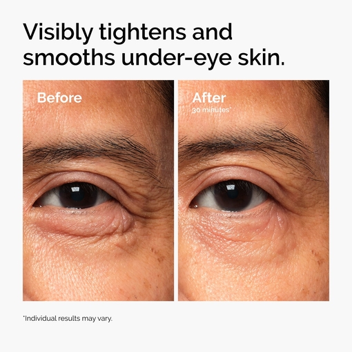 Product Lacto-PDRN* 4% + B9 Eye Cream 15ml base image