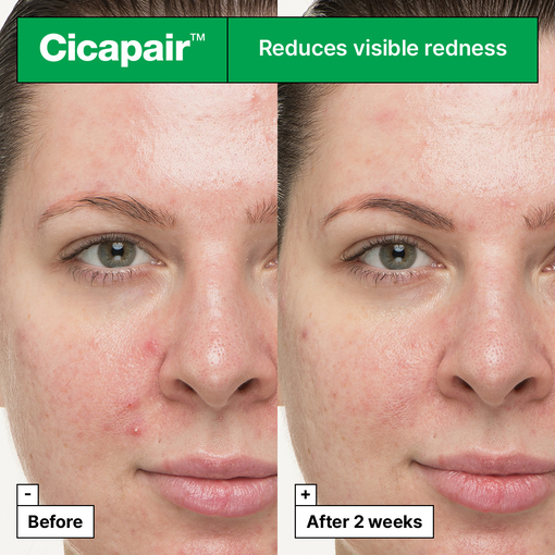 Product Cicapair™ So Soothing Treatment 30ml base image