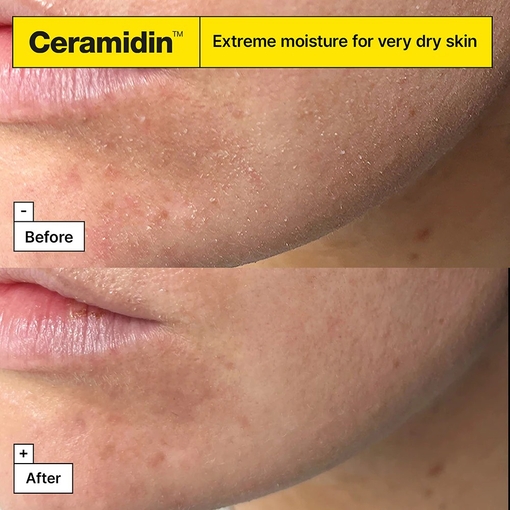 Product Ceramidin™ Ectoin®-Infused Cream 50ml base image