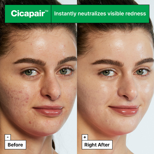 Product Cicapair™ Soothing Color Correcting Treatment SPF30 15ml base image