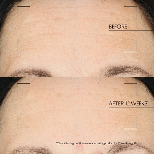 Product Advanced Night Repair Overnight Treatment 65ml base image