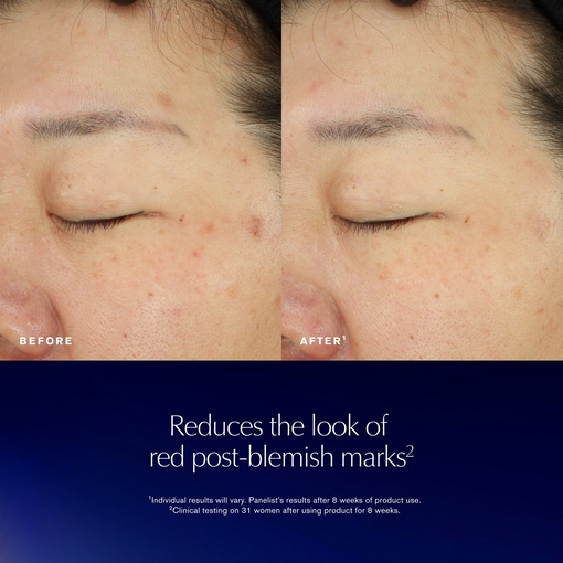 Product Advanced Night Repair - Recovery Treatment Essence Lotion 100ml base image