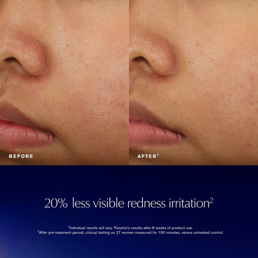 Product Advanced Night Repair - Recovery Treatment Essence Lotion 100ml base image